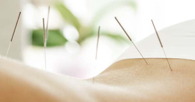 Dry Needling